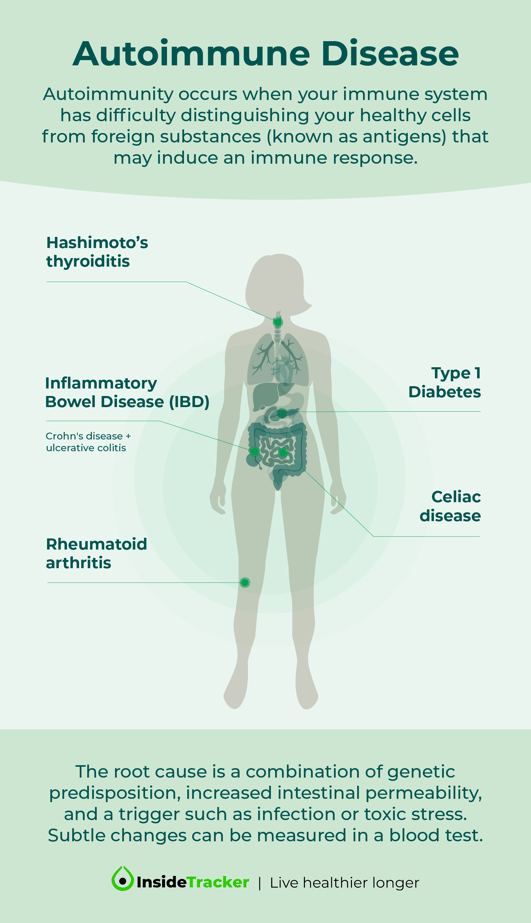autoimmune disease infographic