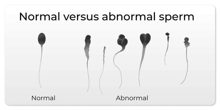 normalvsabnormal sperm